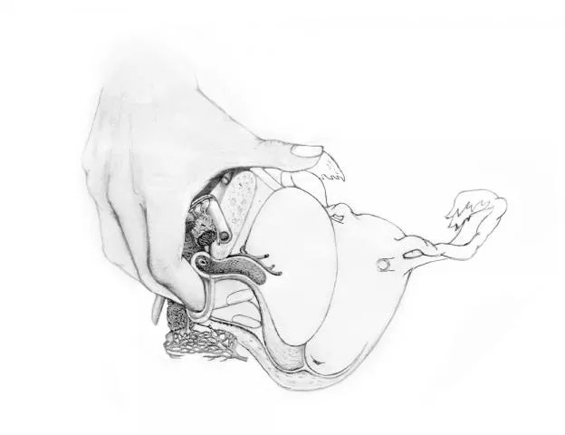 drawing of stimulation of urethral sponge through the vaginal barrel